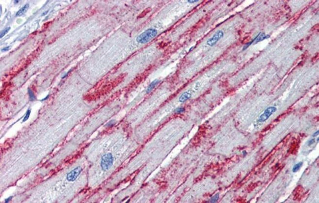 PNPase Antibody in Immunohistochemistry (IHC)