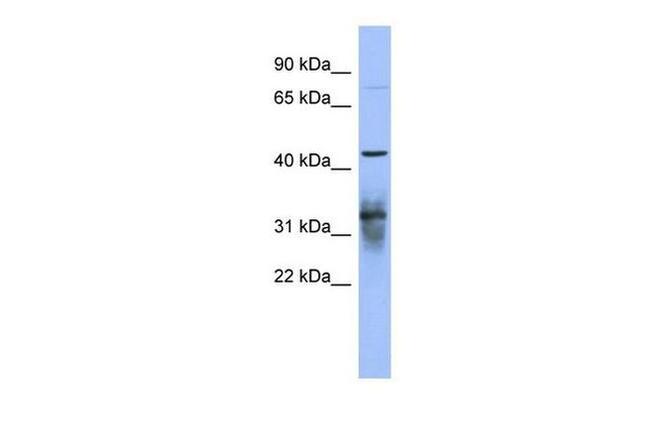 PABPC5 Antibody in Western Blot (WB)