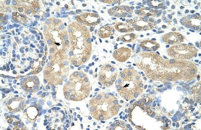 RAVER1 Antibody in Immunohistochemistry (Paraffin) (IHC (P))