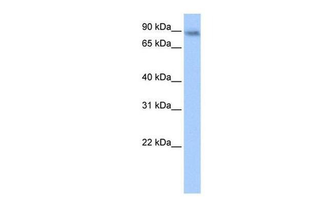 JAKMIP1 Antibody in Western Blot (WB)