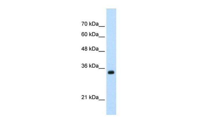 APOBEC3D Antibody in Western Blot (WB)