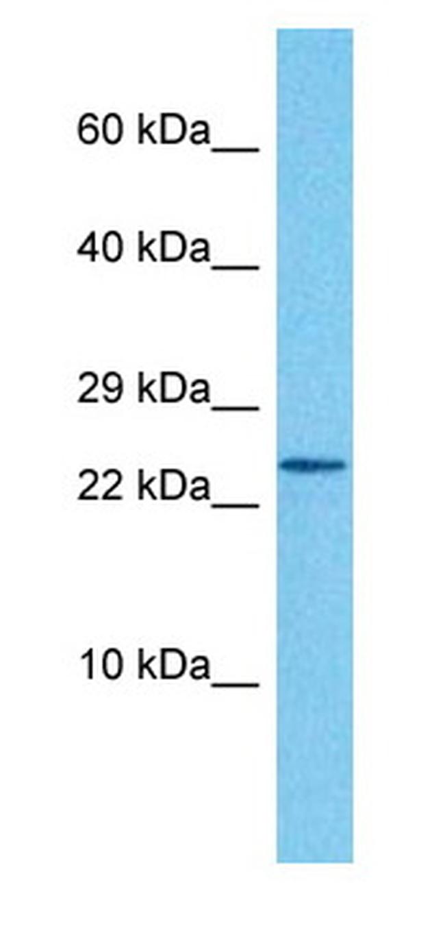 RBM24 Antibody in Western Blot (WB)