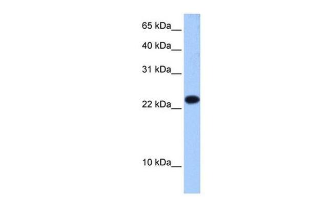 eIF4E3 Antibody in Western Blot (WB)