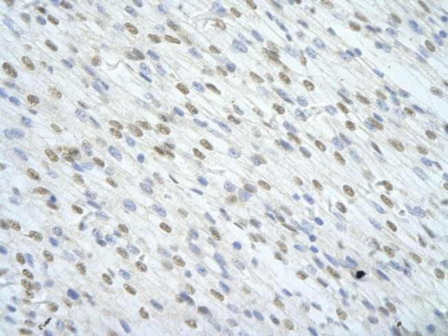 SF1 Antibody in Immunohistochemistry (Paraffin) (IHC (P))