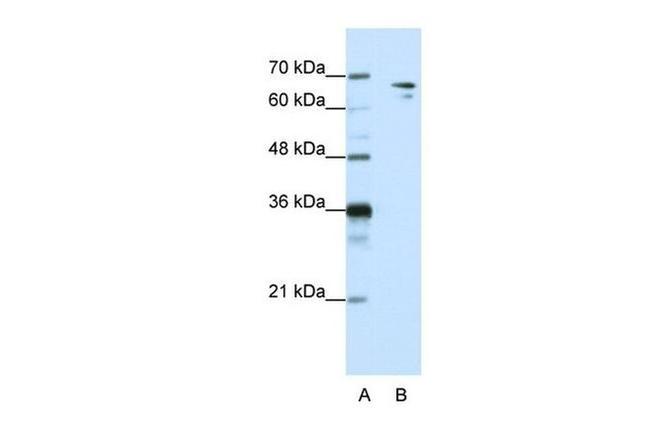 SF1 Antibody in Western Blot (WB)