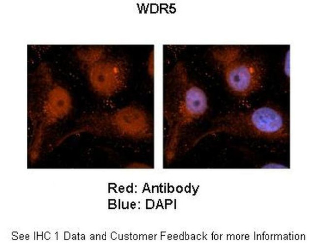 WDR5 Antibody in Immunohistochemistry (IHC)