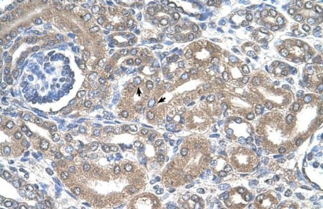 NKCC2 Antibody in Immunohistochemistry (Paraffin) (IHC (P))