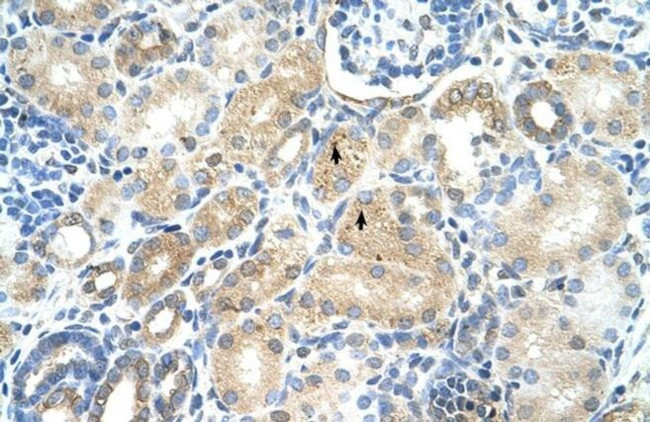 MAT1A Antibody in Immunohistochemistry (Paraffin) (IHC (P))