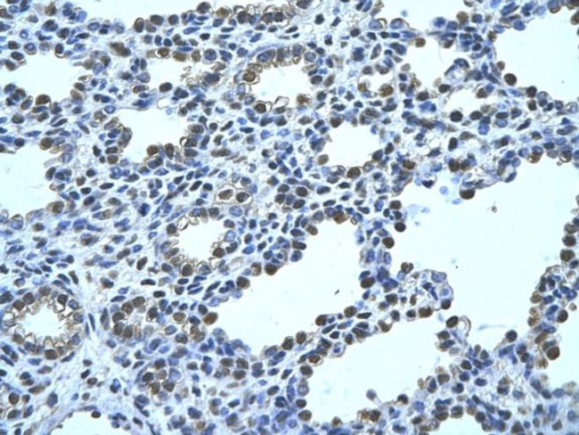 FBP1 Antibody in Immunohistochemistry (Paraffin) (IHC (P))