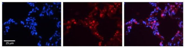 SFTPB Antibody in Immunohistochemistry (Paraffin) (IHC (P))