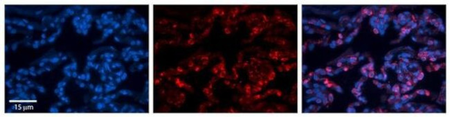 Folate Receptor alpha Antibody in Immunohistochemistry (Paraffin) (IHC (P))