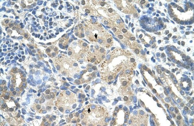 PRPS2 Antibody in Immunohistochemistry (Paraffin) (IHC (P))