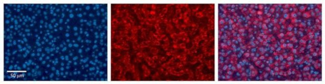 UGT1A6 Antibody in Immunohistochemistry (Paraffin) (IHC (P))