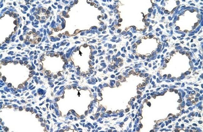 EMP2 Antibody in Immunohistochemistry (Paraffin) (IHC (P))