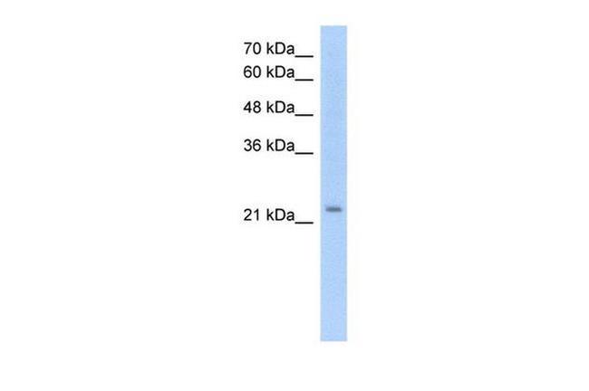 EMP2 Antibody in Western Blot (WB)