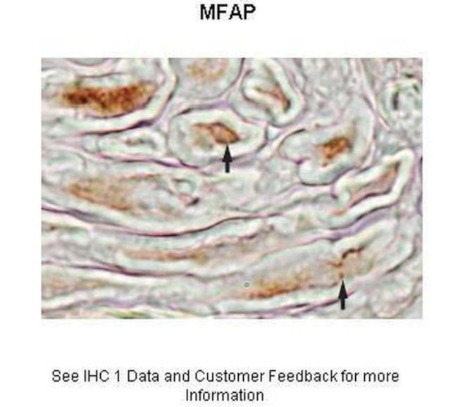 MFAP4 Antibody in Immunohistochemistry (IHC)