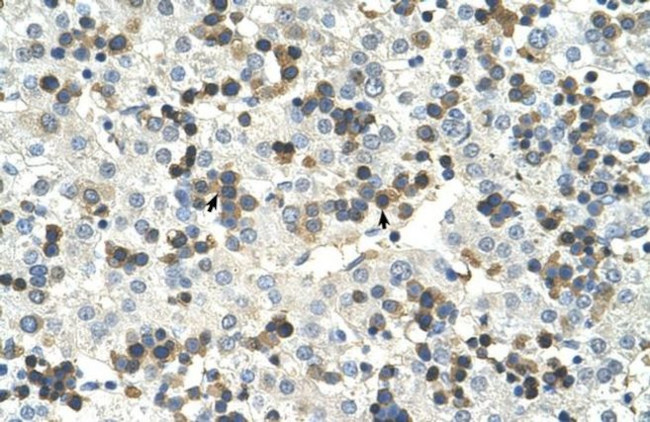 HSD17B6 Antibody in Immunohistochemistry (Paraffin) (IHC (P))