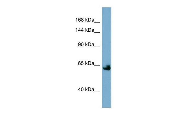 Klotho Antibody in Western Blot (WB)