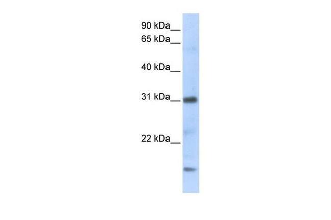 CXCL16 Antibody in Western Blot (WB)