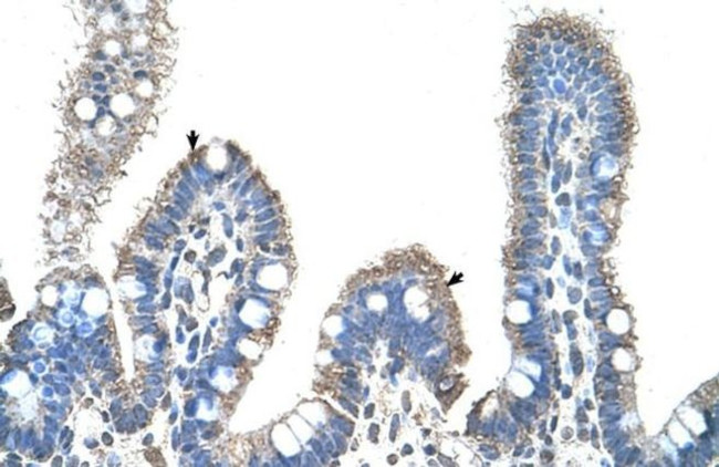 SLC22A1 Antibody in Immunohistochemistry (Paraffin) (IHC (P))