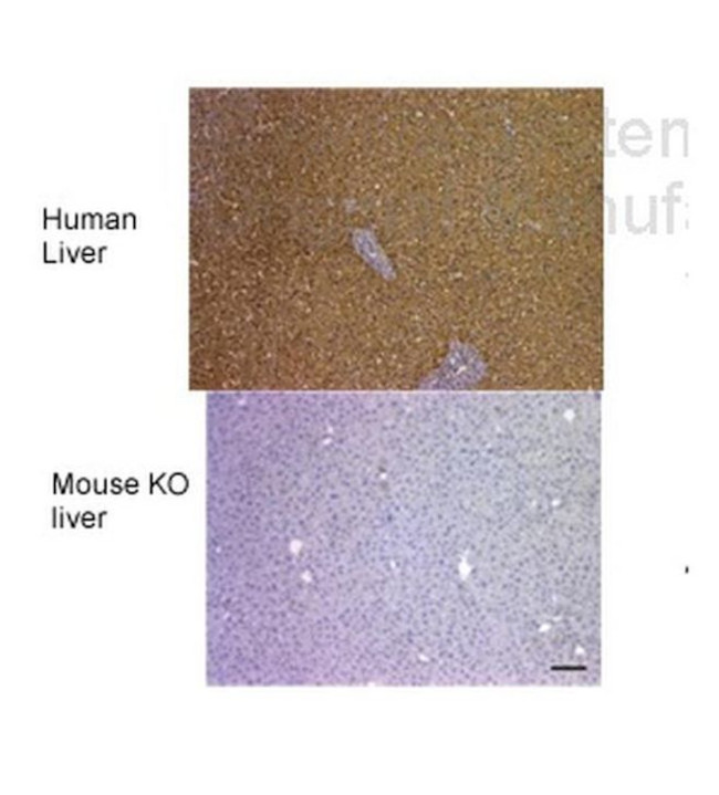 FAH Antibody in Immunohistochemistry (IHC)