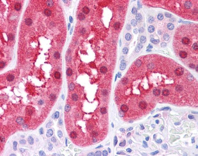 FAH Antibody in Immunohistochemistry (IHC)