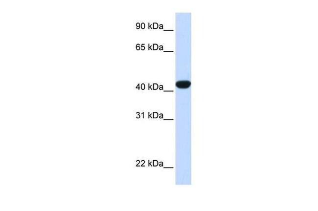 FAH Antibody in Western Blot (WB)