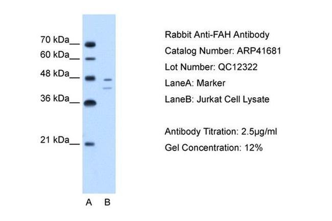 FAH Antibody in Western Blot (WB)