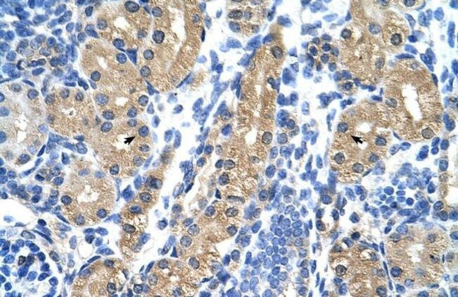 HSD17B1 Antibody in Immunohistochemistry (Paraffin) (IHC (P))