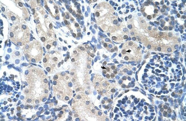 LOR Antibody in Immunohistochemistry (Paraffin) (IHC (P))