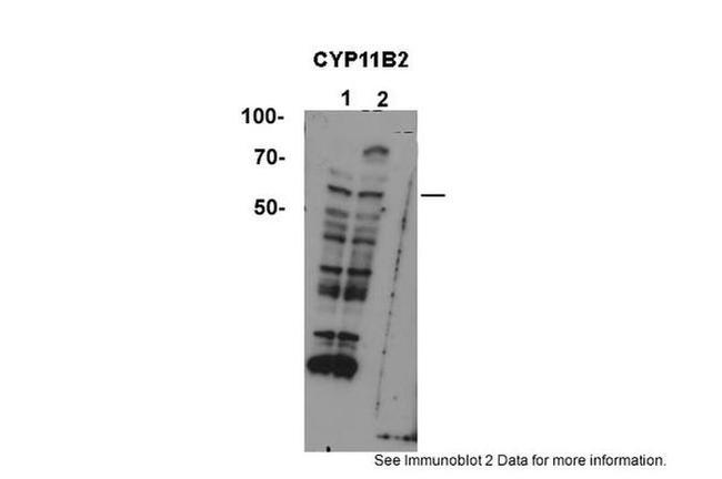 CYP11B2 Antibody in Western Blot (WB)