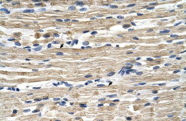 GSTM2 Antibody in Immunohistochemistry (Paraffin) (IHC (P))