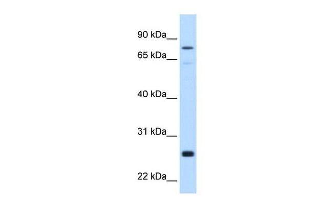 GSTM2 Antibody in Western Blot (WB)