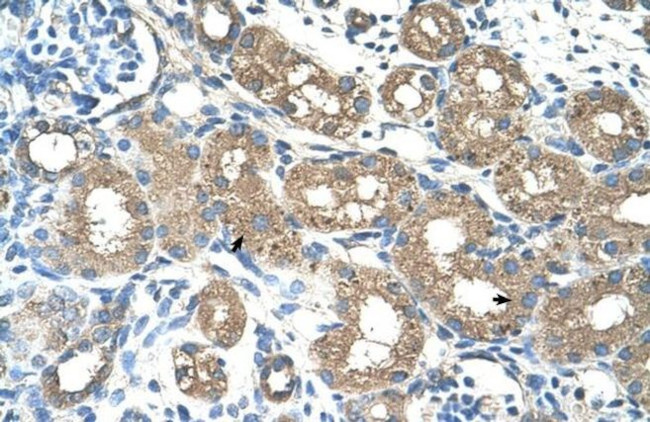 ALAS2 Antibody in Immunohistochemistry (Paraffin) (IHC (P))