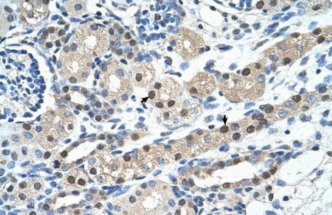 IGSF1 Antibody in Immunohistochemistry (Paraffin) (IHC (P))