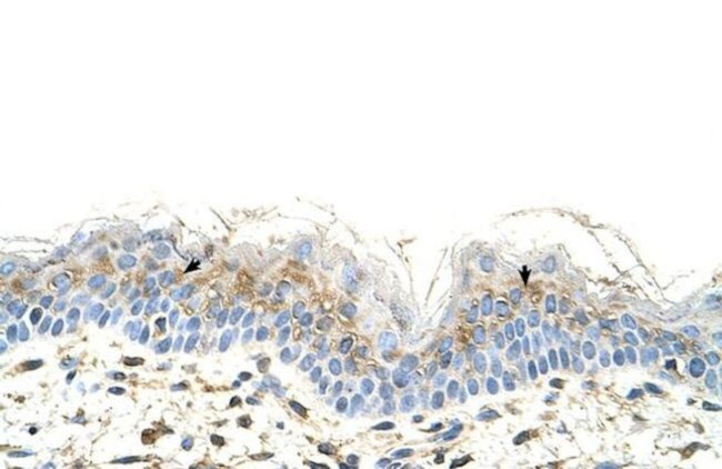 S100A3 Antibody in Immunohistochemistry (Paraffin) (IHC (P))