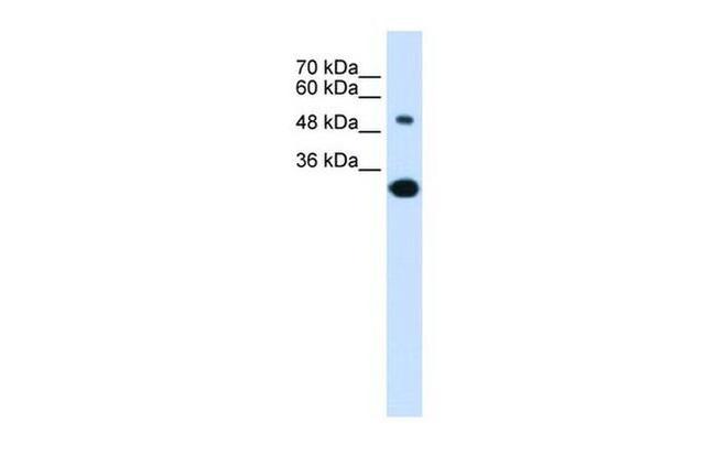 SLC2A5 Antibody in Western Blot (WB)