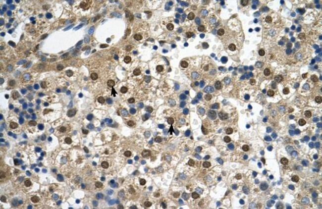 SQLE Antibody in Immunohistochemistry (Paraffin) (IHC (P))