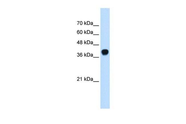 SQLE Antibody in Western Blot (WB)