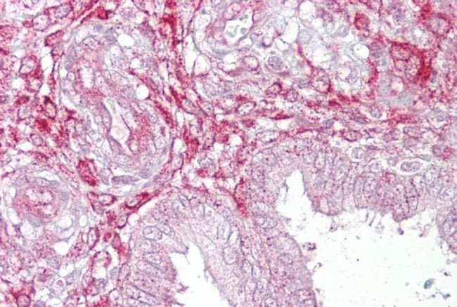 LEFTY2 Antibody in Immunohistochemistry (IHC)