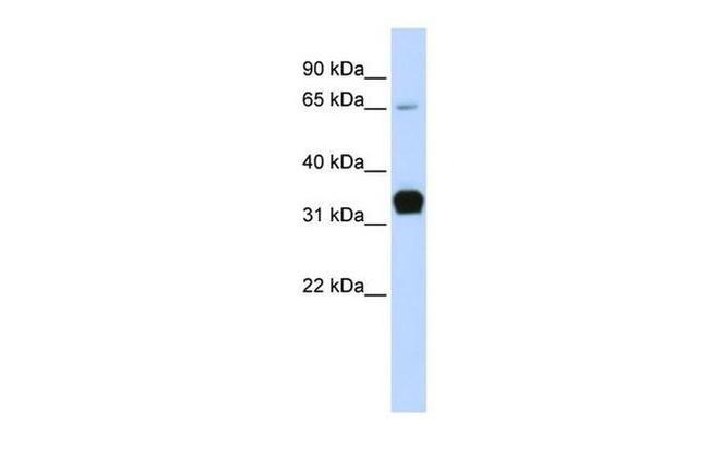 TNNT1 Antibody in Western Blot (WB)