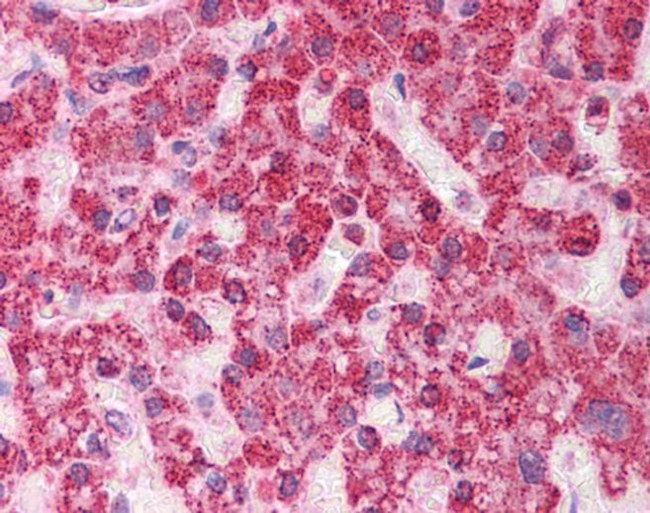 TST Antibody in Immunohistochemistry (Paraffin) (IHC (P))