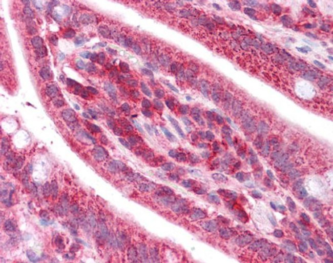 TST Antibody in Immunohistochemistry (Paraffin) (IHC (P))