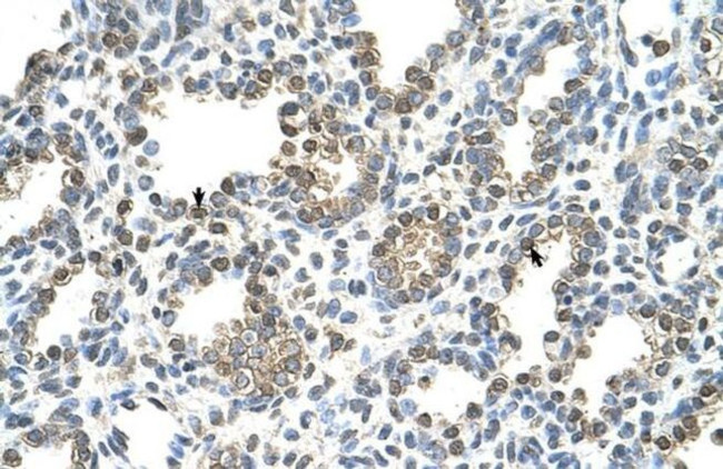 TST Antibody in Immunohistochemistry (Paraffin) (IHC (P))