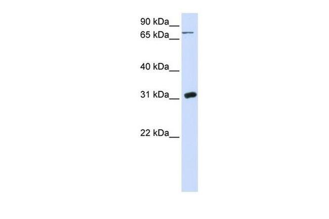 UPP1 Antibody in Western Blot (WB)