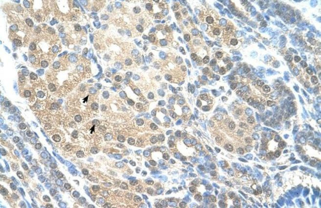 RAD23A Antibody in Immunohistochemistry (Paraffin) (IHC (P))