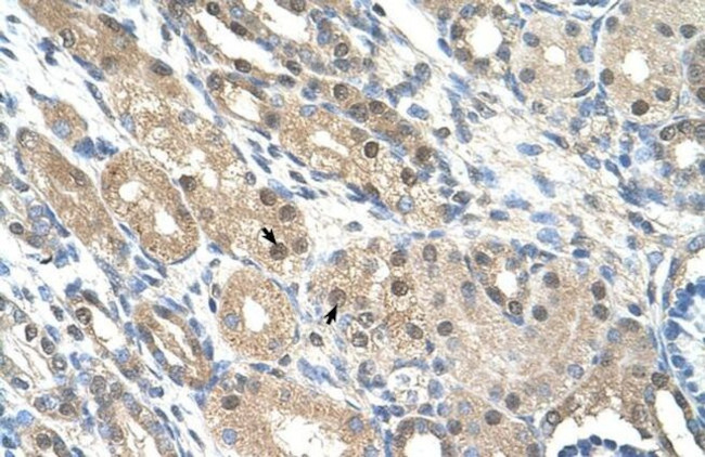 GEM Antibody in Immunohistochemistry (Paraffin) (IHC (P))