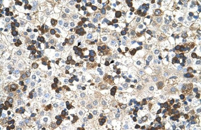 HBZ Antibody in Immunohistochemistry (Paraffin) (IHC (P))