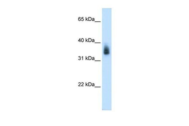 MAGEA8 Antibody in Western Blot (WB)