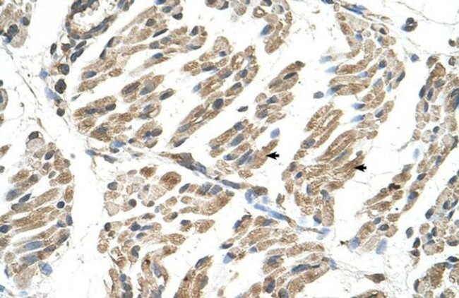 SLC6A8 Antibody in Immunohistochemistry (Paraffin) (IHC (P))